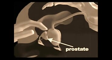 মহিলার পাছা মধ্যে পায়ু অনুপ্রবেশ পরে, লোক তার মুখের মধ্যে cums সেক্সি সেক্সি বিএফ